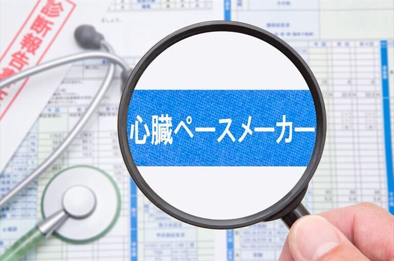 ペースメーカーの役割